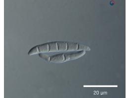 영광군, 맥류 출수기 붉은곰팡이병 등 병해충 적기 방제 당부 기사 이미지