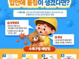 원주시보건소, 수족구병 유행 지속…예방수칙 준수 당부 기사 이미지